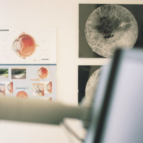 Laserterapia Argon e YAG Laser